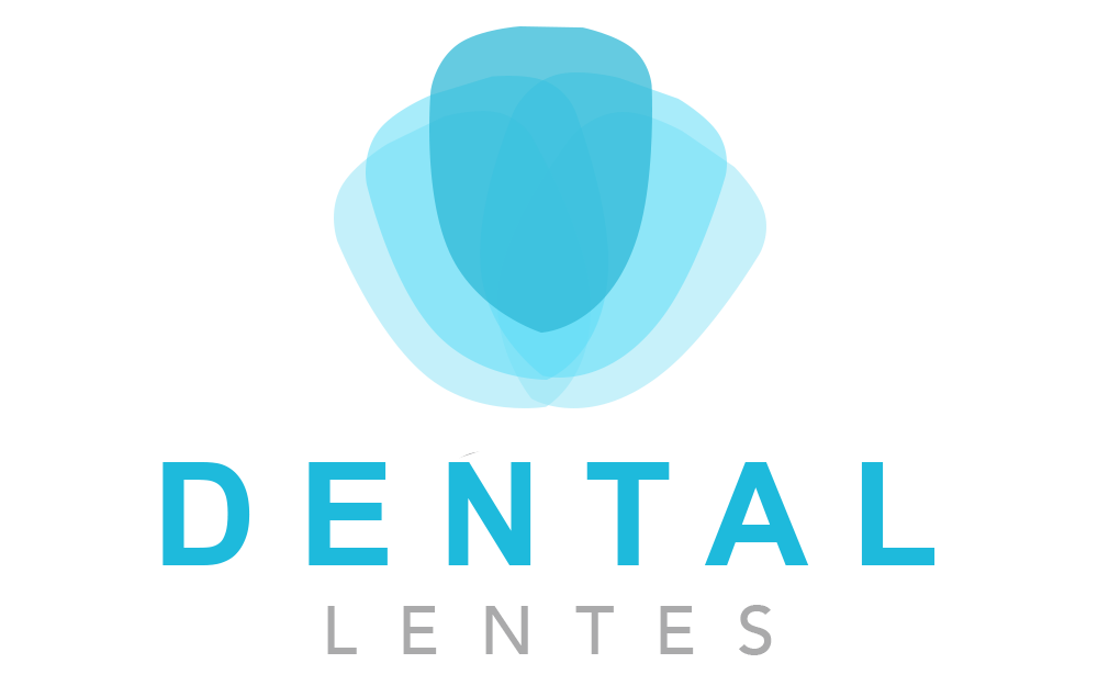Lentes de Contato Dental | Dental Lentes